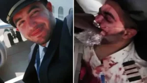 The image shows a pilot in uniform, first appearing in a professional setting and then in a distressed state with visible injuries and blood, suggesting a serious incident.